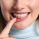 what to know about periodontal disease