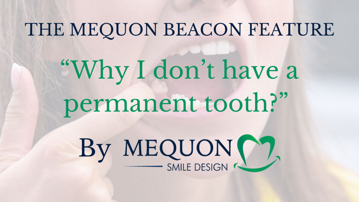 why I don't have a permanent tooth mequon dentist feature