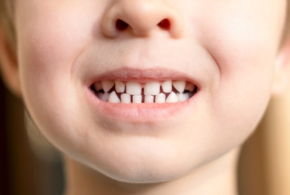 What to know about baby teeth from a Mequon dentist