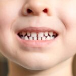 What to know about baby teeth from a Mequon dentist