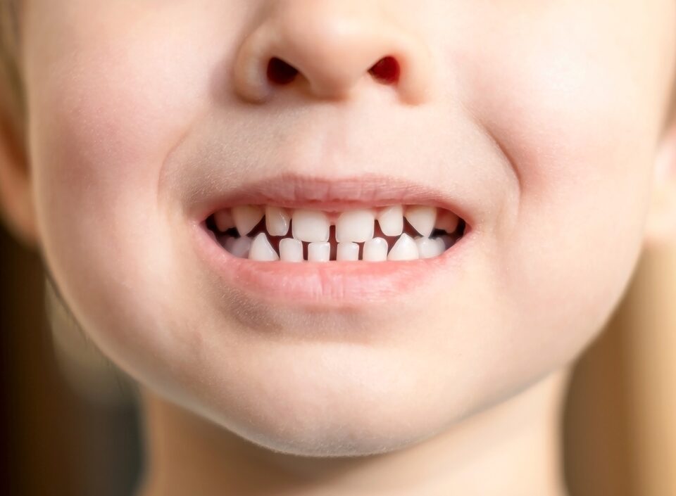 What to know about baby teeth from a Mequon dentist