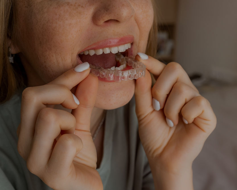 orthodontic-treatment-home-thumb